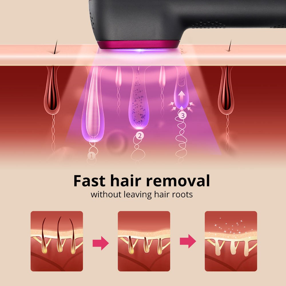 1PCS Laser Hair Removal For Women And Man 100,000 Flashes IPL Painless Laser Hair Removal - IVOIRART.COM
