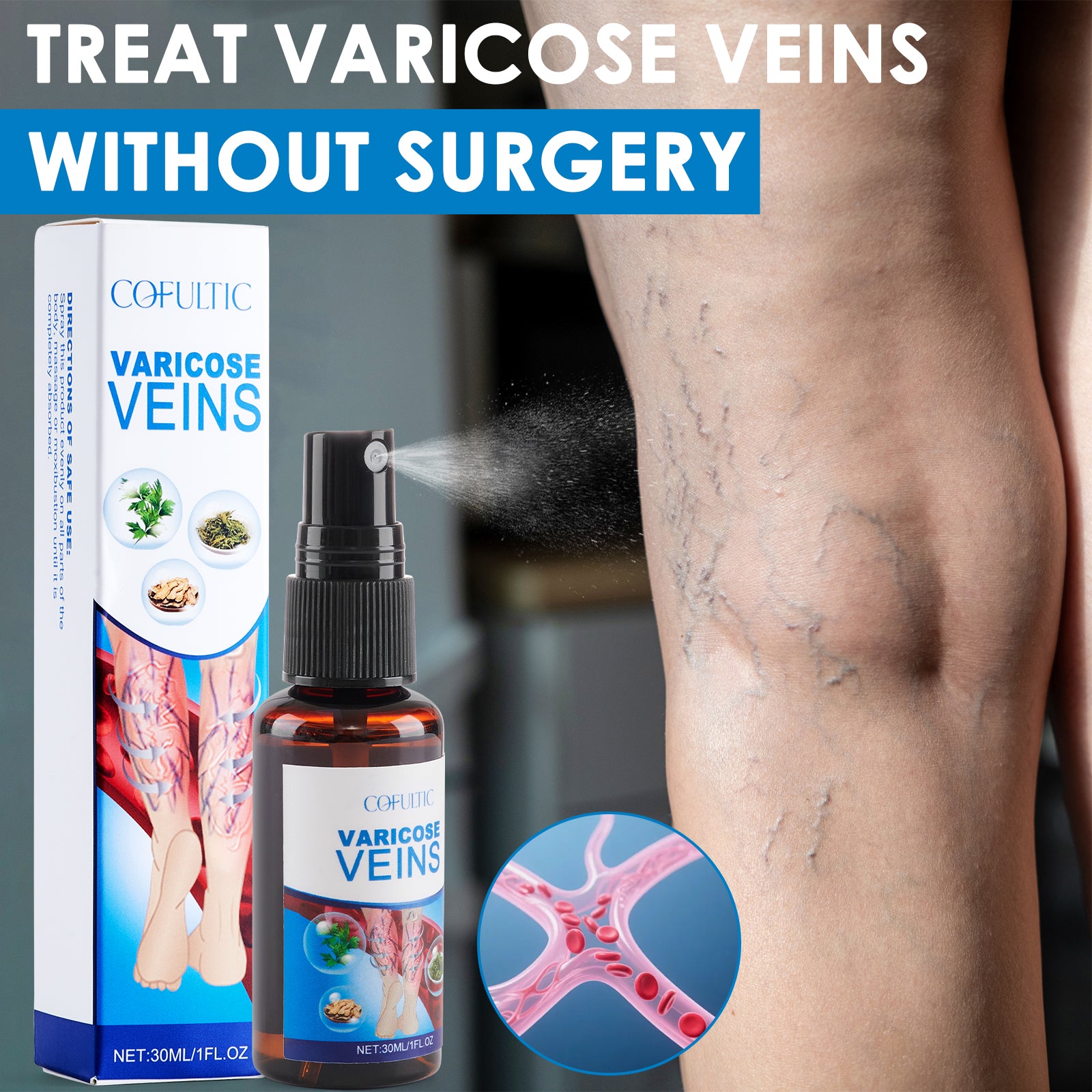 Spray anti-varices 30 ml multi-usage pour soin des genoux et jambes favorisant la circulation sanguine