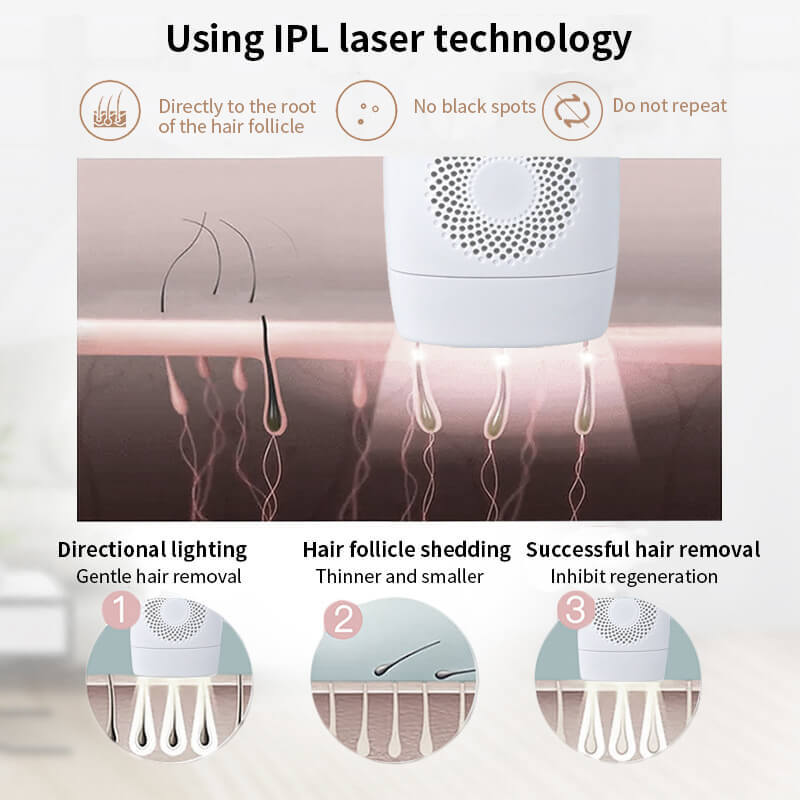 Appareil d'épilation laser IPL haute performance 990 000 impulsions pour peau lisse - IVOIRART.COM