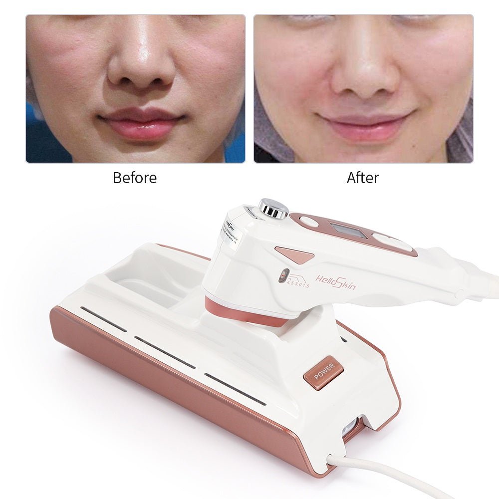 Home V Face Lifting Ultrasonic Knife Lifting Anti-aging Beauty Instrument - IVOIRART.COM