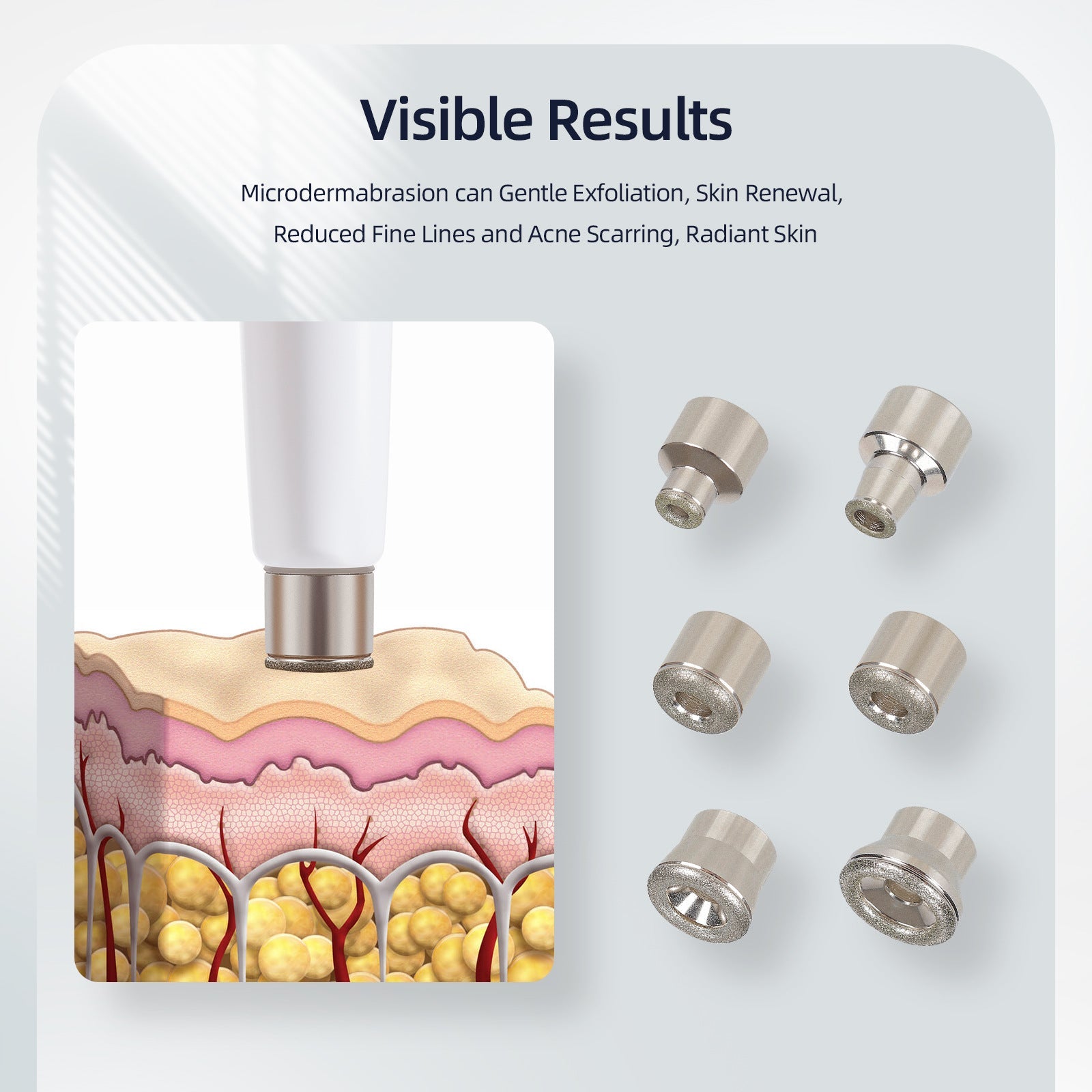 Light Yellow Skin Rejuvenation Skin Exfoliating Layer Beauty Instrument - IVOIRART.COM