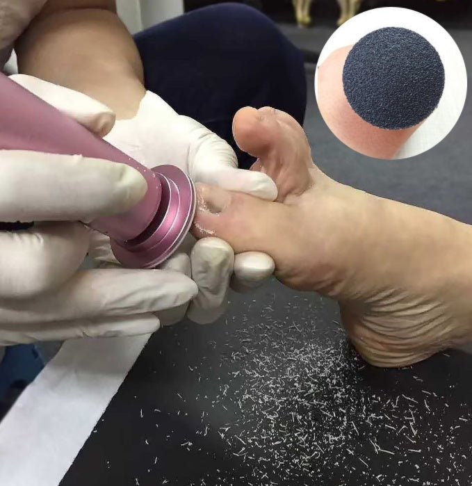 Outil Électrique de Pédicure Rechargeable pour Pieds, Lime à Callosités et Peau Morte - IVOIRART.COM