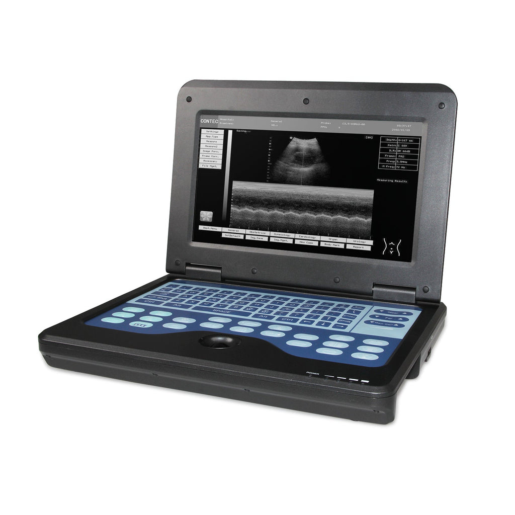 Portable Ultrasound Scanner Laptop Digital Diagnostic Machine 3.5 Convex Probe - IVOIRART.COM