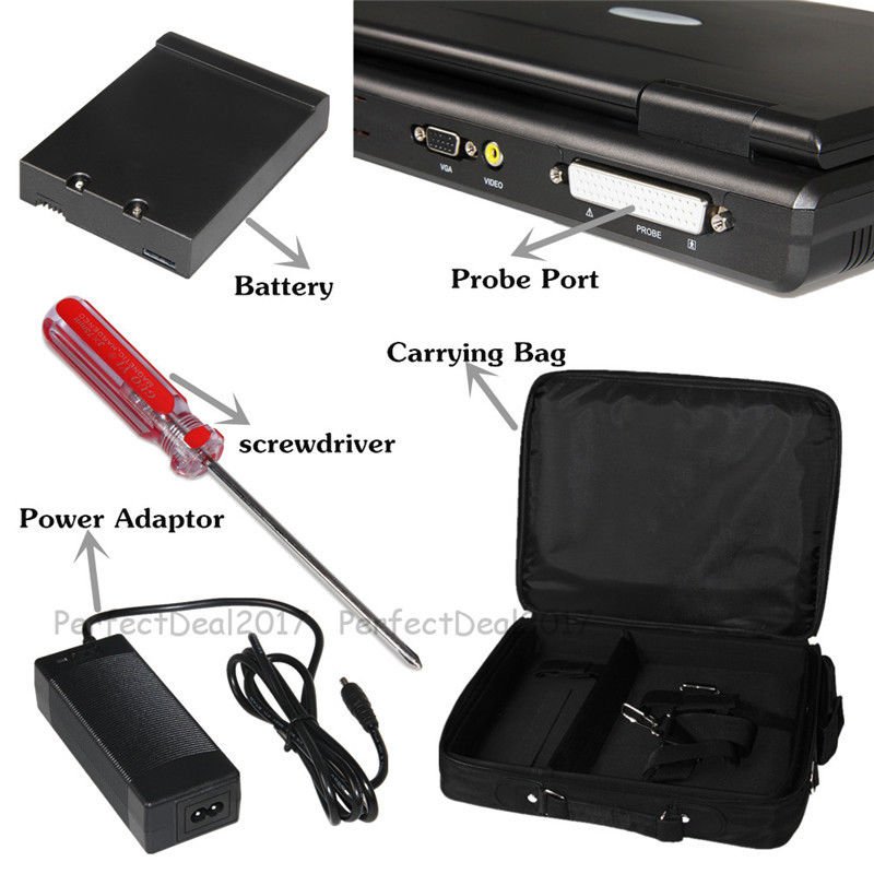 Portable Ultrasound Scanner Laptop Digital Diagnostic Machine 3.5 Convex Probe - IVOIRART.COM