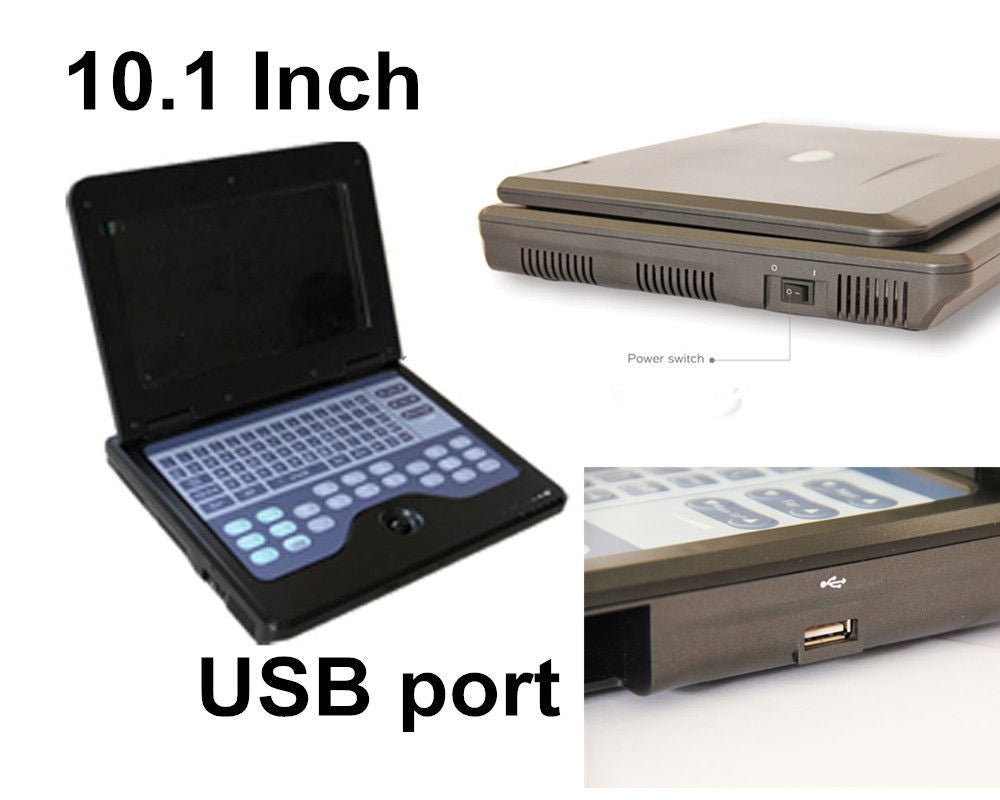 Portable Ultrasound Scanner Laptop Digital Diagnostic Machine 3.5 Convex Probe - IVOIRART.COM