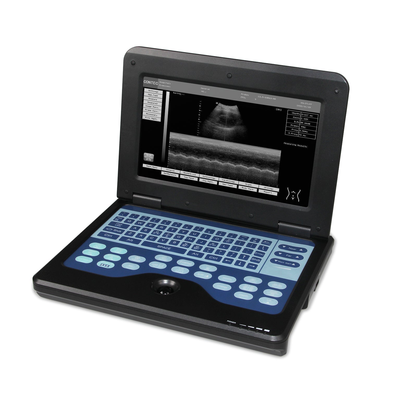 Portable Ultrasound Scanner Laptop Digital Diagnostic Machine 3.5 Convex Probe - IVOIRART.COM