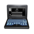 Portable Ultrasound Scanner Laptop Digital Diagnostic Machine 3.5 Convex Probe - IVOIRART.COM