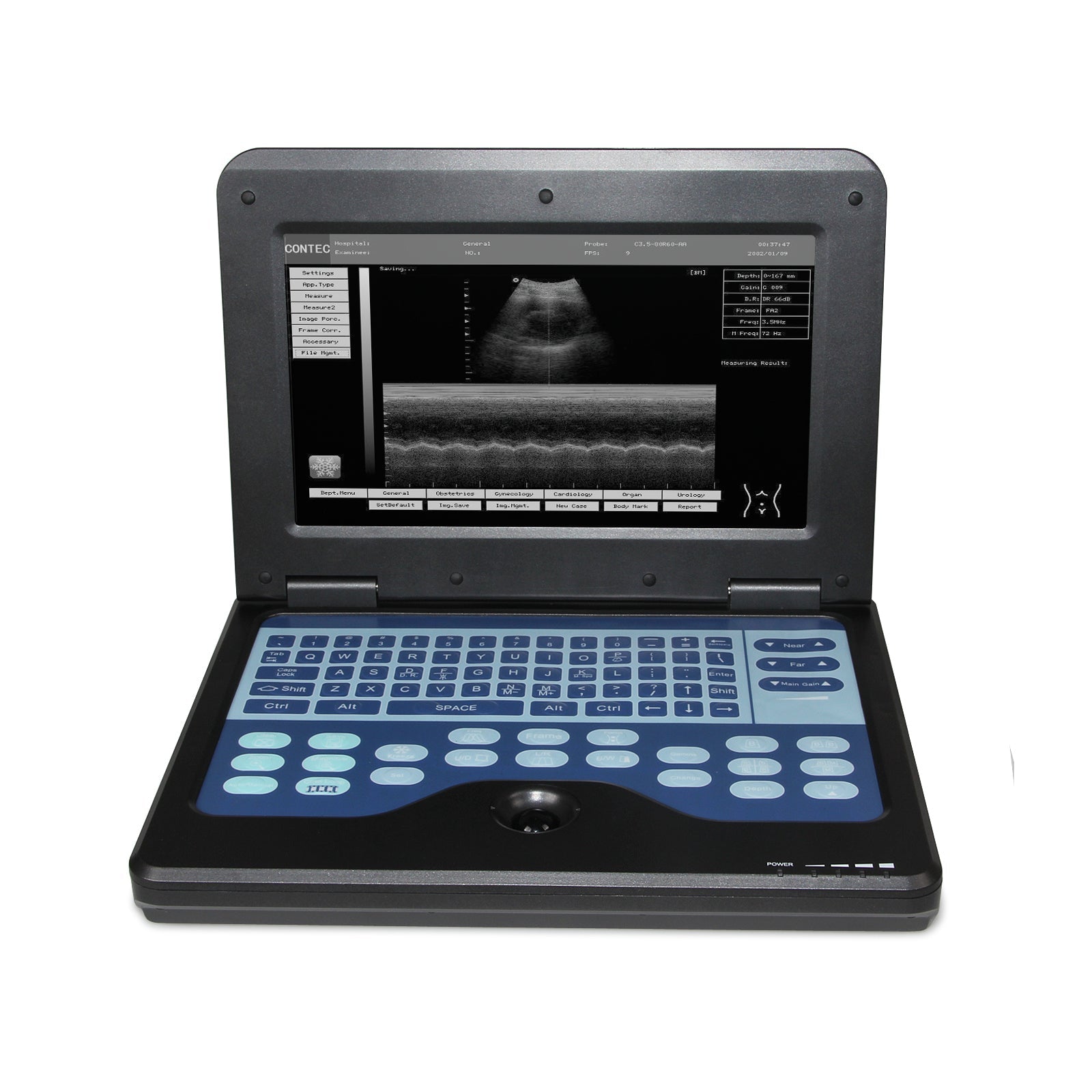Portable Ultrasound Scanner Laptop Digital Diagnostic Machine 3.5 Convex Probe - IVOIRART.COM